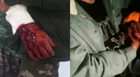 Pelea callejera deja dos heridos en Huancayo