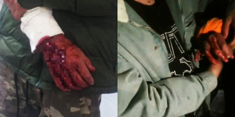 Pelea callejera deja dos heridos en Huancayo